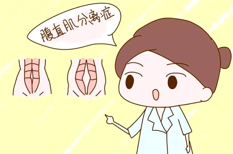 腹直肌分離問題，產(chǎn)后康復治療儀幫助您
