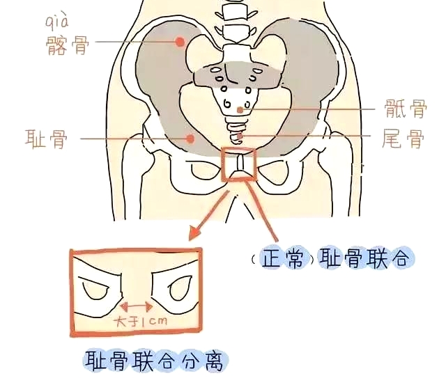 盆底肌康復(fù)治療儀，產(chǎn)后媽媽不再擔(dān)心