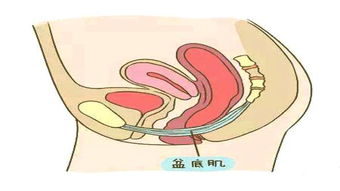 盆底肌康復(fù)治療儀，如何讓盆底肌康復(fù)評估報告更可靠