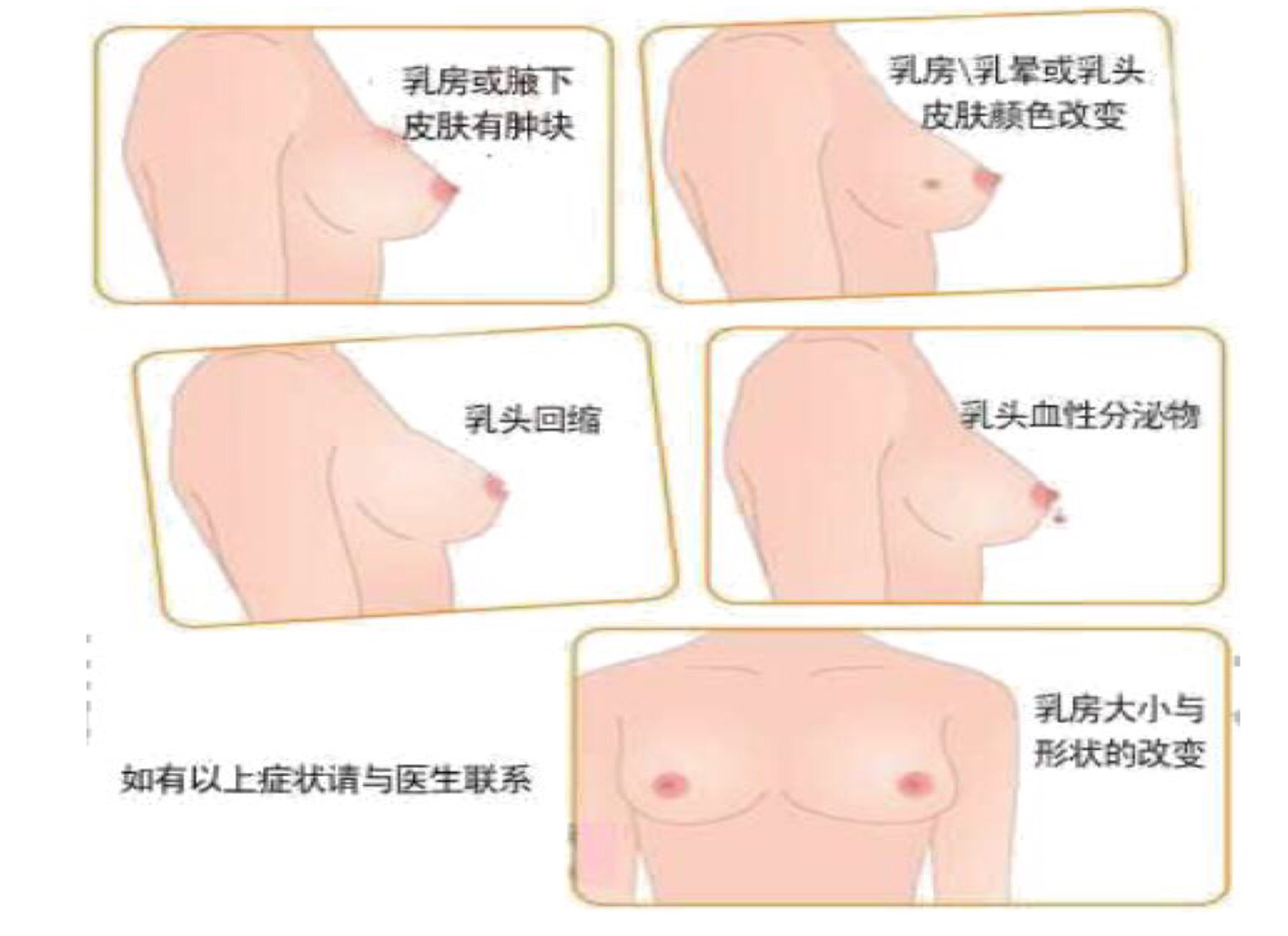 對產婦產后康復的效果，便攜產后康復治療儀的作用遠不如此